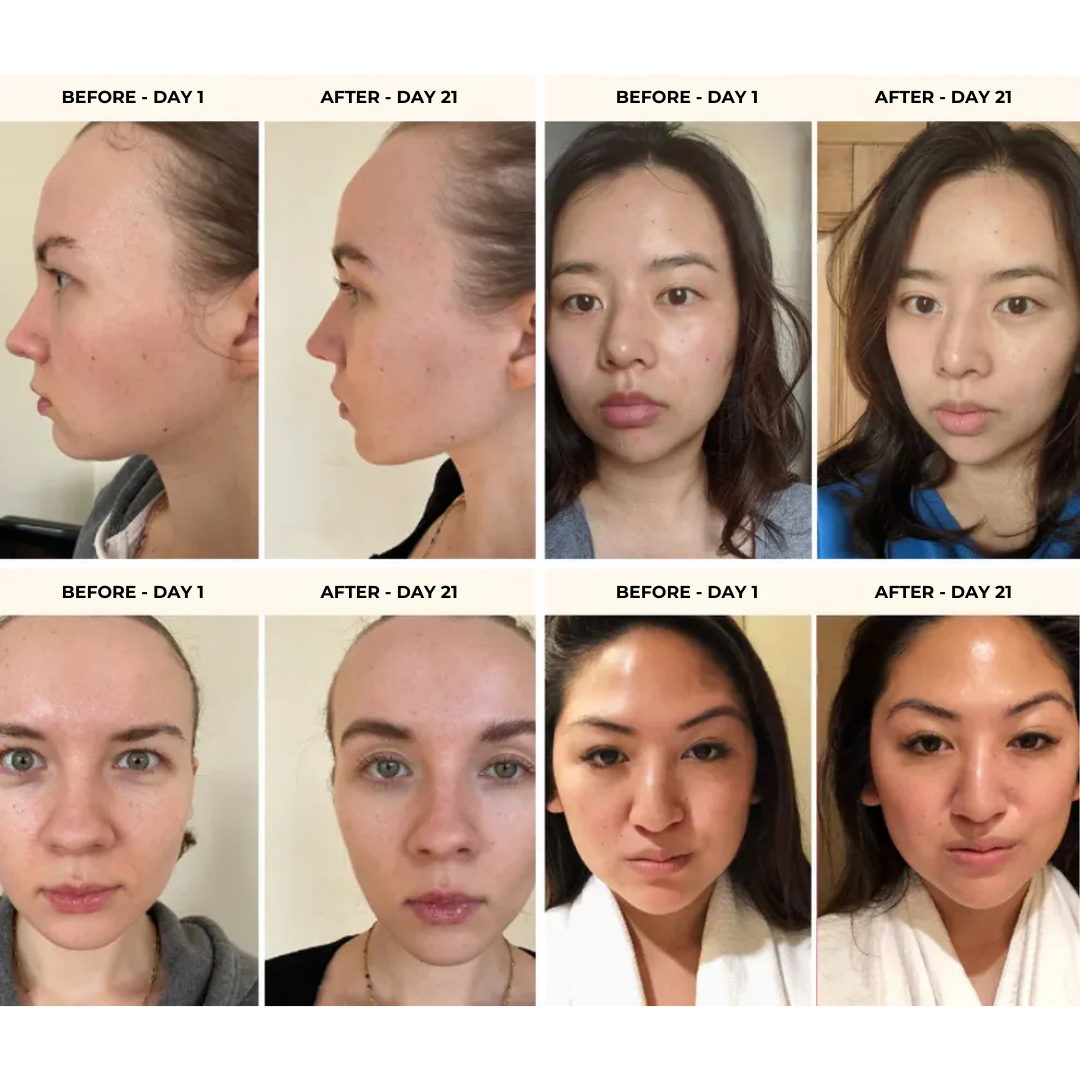 Nulifra™ YouthGlow – Advanced Skin Tightening Massager