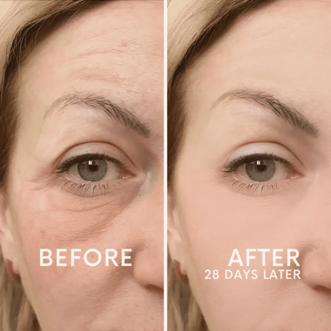 Nulifra™ YouthGlow – Advanced Skin Tightening Massager
